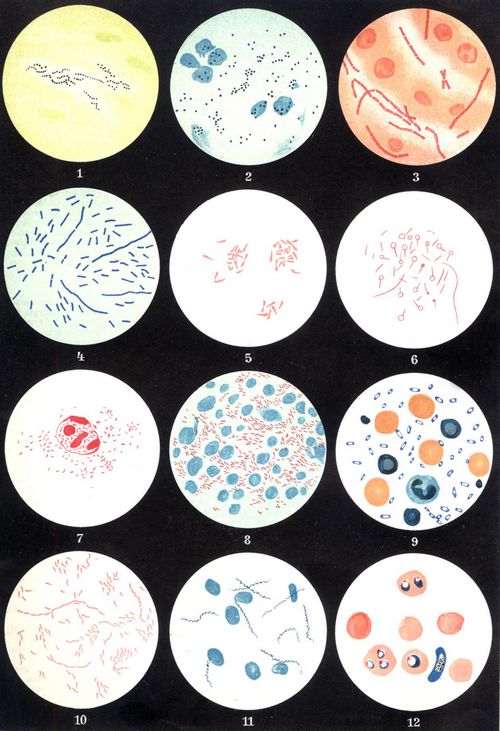 Bakterien. 1. Streptokokken. 2. Staphylokokken. 3. Milzbrand. 4. Unterleibstyphus. 5. Diphtherie. 6. Wundstarrkrampf (Tetanus). 7. Influenza. 8. Tuberkulose. 9. Pest. 10. Cholera. 11. R�ckfalltyphus. 12. Malaria. (1., 2., 3., 4., 5., 6., 8., 10., 11. in 600facher, 7., 9., 12. in 100facher Vergr�sserung.)