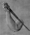 D�rer, Albrecht: Arm der Lukretia