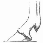 Fig. 3. Spitzer Huf.
