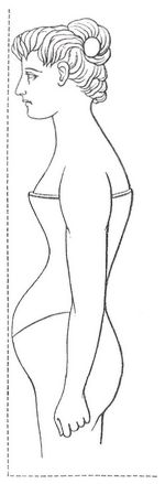 Fig. 2. K�rperform bei Schn�rung.