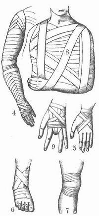 Fig. 4. Armverband. 5. Verband des Handgelenkes. 6. V. des Fu�gelenkes. 7. Knieverband. 8. Dessaultscher Schulterverband. 9. V. nach Amputation eines Fingers.