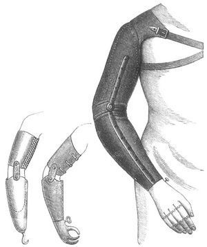 Fig. 3 u. 4. Arbeitsklauen. Fig. 5. K�nstlicher Oberarm.