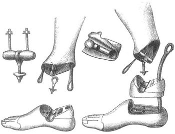 Fig. 1. Kunstbein mit einfachem Gelenk. Fig. 2. Kunstbein mit doppeltem Gelenk.