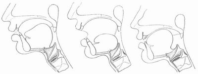 Fig. 1. Bildung des u. Fig. 2. Bildung des a. Fig. 3. Bildung des i.