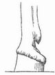 Fig. 4. Stumpfer Huf.