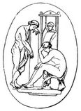 Fig. 2: Achilles